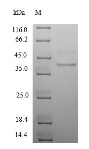 SDS-PAGE - Recombinant Human Cytomegalovirus AD169 protein (Tagged) (AB236187)