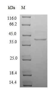 SDS-PAGE - Recombinant Human Cytomegalovirus AD169 protein (Tagged) (AB236187)