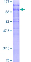 SDS-PAGE - Recombinant Human DAB2 protein (AB132218)
