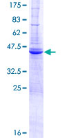 SDS-PAGE - Recombinant Human DAI protein (AB153528)