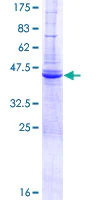 SDS-PAGE - Recombinant Human DAI protein (AB153528)