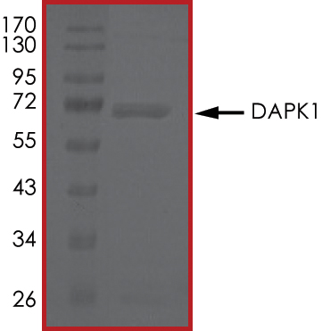 SDS-PAGE - Recombinant human DAP Kinase 1 protein (AB63191), expandable thumbnail