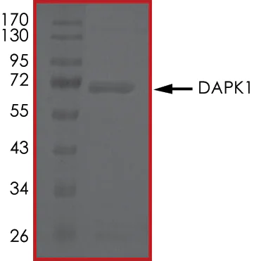 SDS-PAGE - Recombinant human DAP Kinase 1 protein (AB63191)