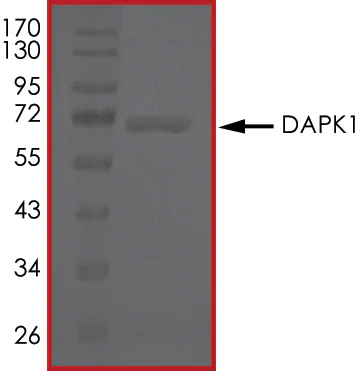 SDS-PAGE - Recombinant human DAP Kinase 1 protein (GST tag N-Terminus) (AB63191)