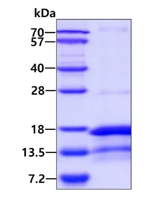 SDS-PAGE - Recombinant Human DAP1 protein (His tag N-Terminus) (AB183219)