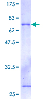 Recombinant Human DAP3 protein