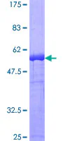 SDS-PAGE - Recombinant Human DAPP1 protein (GST tag N-Terminus) (AB162070)