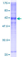 SDS-PAGE - Recombinant Human DARC protein (AB114557), expandable thumbnail