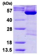 SDS-PAGE - Recombinant Human DARS protein (His tag N-Terminus) (AB124568)