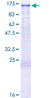 SDS-PAGE - Recombinant Human Daxx protein (AB131785)