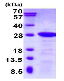 SDS-PAGE - Recombinant Human DBNDD2 protein (AB130032)
