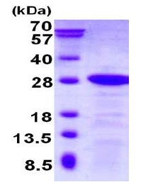 SDS-PAGE - Recombinant Human DBNDD2 protein (His tag N-Terminus) (AB130032)