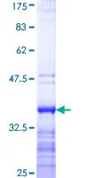 SDS-PAGE - Recombinant Human DBPA protein (GST tag N-Terminus) (AB160078)
