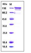 SDS-PAGE - Recombinant Human DC-SIGNR protein (Fc Chimera) (AB276295), expandable thumbnail