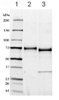 SDS-PAGE - Recombinant Human DC-SIGNR protein (Fc Chimera) (AB83920)