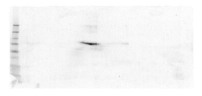 SDS-PAGE - Recombinant Human DC-SIGNR protein (Fc Chimera) (AB83920)