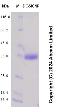 SDS-PAGE - Recombinant Human DC-SIGNR Protein Standard (AB323048)