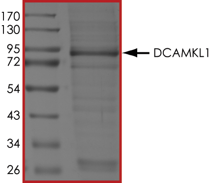 SDS-PAGE - Recombinant human DCAMKL1 protein (Active) (AB268437), expandable thumbnail