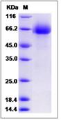 SDS-PAGE - Recombinant Human DCBLD1 protein (His tag) (AB276622)