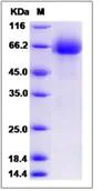 SDS-PAGE - Recombinant Human DCBLD1 protein (His tag) (AB276622)
