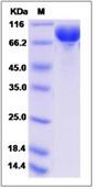 SDS-PAGE - Recombinant Human DCBLD2/ESDN protein (His tag) (AB276565)