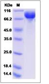 SDS-PAGE - Recombinant Human DCBLD2/ESDN protein (His tag) (AB276565)