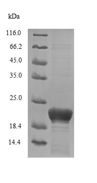 Recombinant Human DCD protein (Tagged)