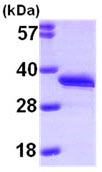 SDS-PAGE - Recombinant Human DCK protein (His tag N-Terminus) (AB99520)