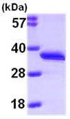 SDS-PAGE - Recombinant Human DCK protein (AB99520)