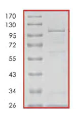 SDS-PAGE - Recombinant human DCLK2 protein (AB85758)