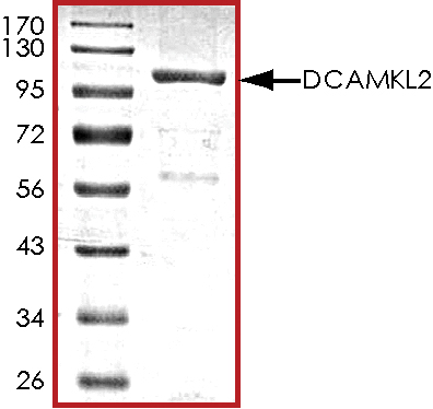 Recombinant human DCLK2 protein