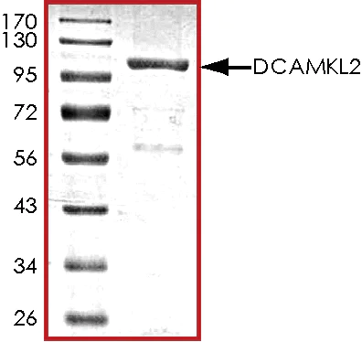 SDS-PAGE - Recombinant human DCLK2 protein (AB85758)