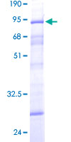 Recombinant Human Dcp2/TDT protein