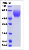 SDS-PAGE - Recombinant human DcR1 protein (His tag) (AB276266)