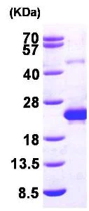 SDS-PAGE - Recombinant Human DCTD protein (His tag N-Terminus) (AB96766)