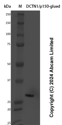 SDS-PAGE - Recombinant Human DCTN1/p150-glued Protein Standard (His tag) (AB323151)