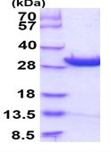 SDS-PAGE - Recombinant Human DCUN1D1 protein (His tag N-Terminus) (AB103056)