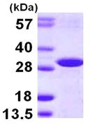 SDS-PAGE - Recombinant Human DCUN1D2 protein (His tag N-Terminus) (AB113157)