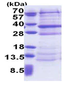 SDS-PAGE - Recombinant Human DCUN1D4 protein (AB171715)