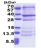 SDS-PAGE - Recombinant Human DCUN1D4 protein (His tag N-Terminus) (AB171715)
