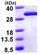 SDS-PAGE - Recombinant Human DCXR protein (AB98147)