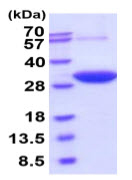 Recombinant human DCXR protein (Active)