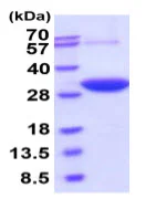 SDS-PAGE - Recombinant human DCXR protein (Active) (His tag N-Terminus) (AB219429)