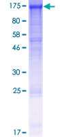 SDS-PAGE - Recombinant Human DDB1 protein (GST tag N-Terminus) (AB114333)