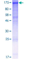 SDS-PAGE - Recombinant Human DDB1 protein (GST tag N-Terminus) (AB114333)