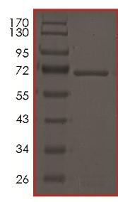 Recombinant human DDR2 (mutated T654M) protein