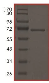 SDS-PAGE - Recombinant human DDR2 (mutated T654M) protein (AB179952)