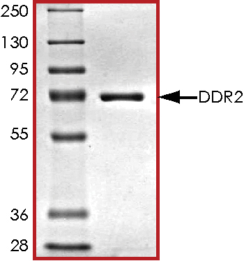 SDS-PAGE - Recombinant human DDR2 protein (AB96401), expandable thumbnail