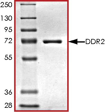 SDS-PAGE - Recombinant human DDR2 protein (AB96401)