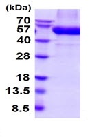 SDS-PAGE - Recombinant Human DDR2 protein (AB222446)
